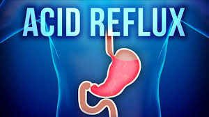 Acid Reflux Glycerite