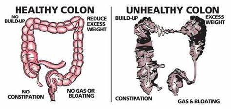 Colon Detox Glycerite
