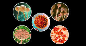 Fungi-Gone TOPICAL